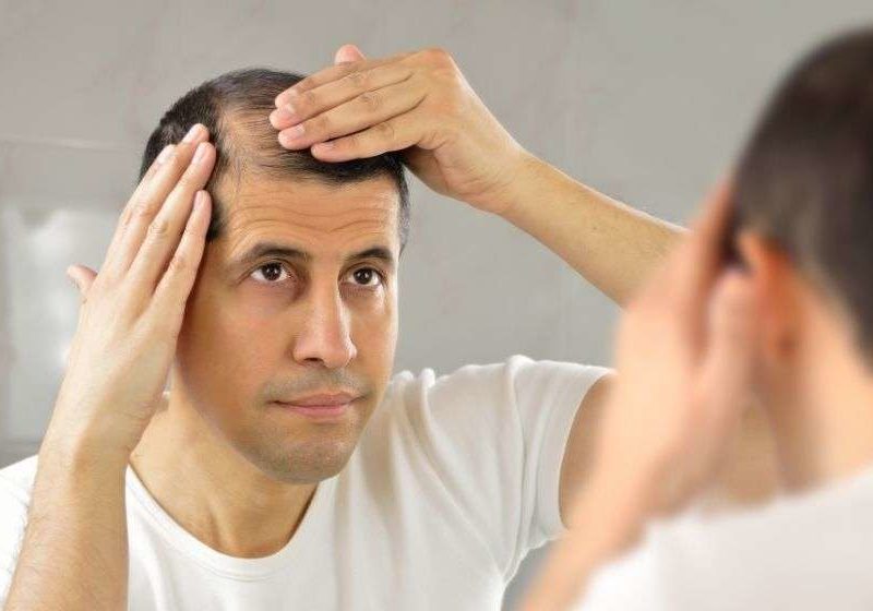 a man hav?ng hair loss is looking into the mirror | Feature | 5 Ways To Deal With Receding Hairline In Men