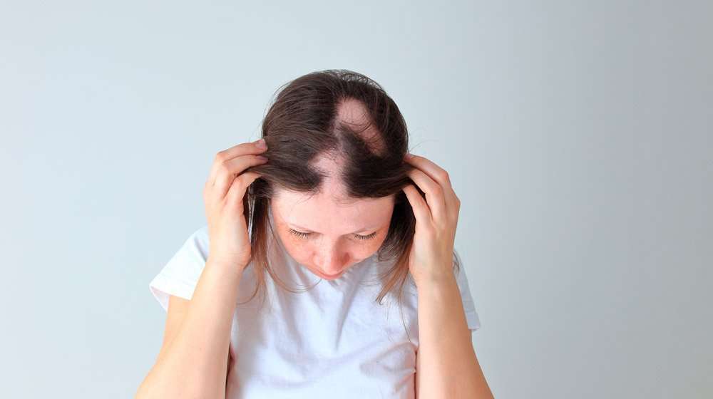 What Is Alopecia Barbae And Why It Happens?