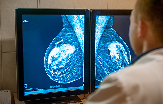 Doctor-examines-mammogram-snapshot-of-breast-of-female-patient-on-the-monitors-Types-of-Hormone-Therapy-for-Breast-Cancer