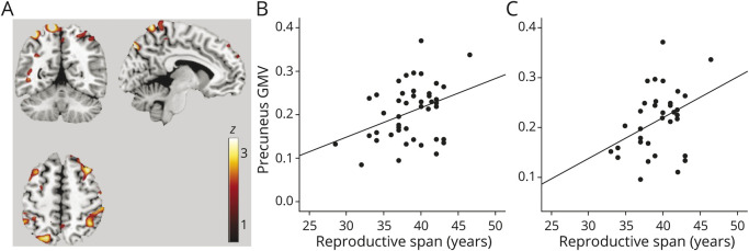 Associations between reproductive span and gray matter volume. Source: American Academy of Neurology.